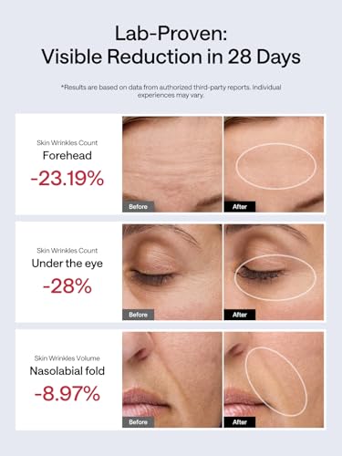 Facial Toning Device, Microcurrent Facial Device, Red Light Therapy, 4 Modes, 5 Intensity Levels Q93796