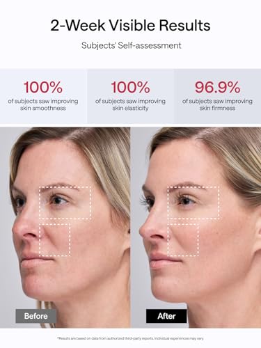 Facial Toning Device, Microcurrent Facial Device, Red Light Therapy, 4 Modes, 5 Intensity Levels Q93796
