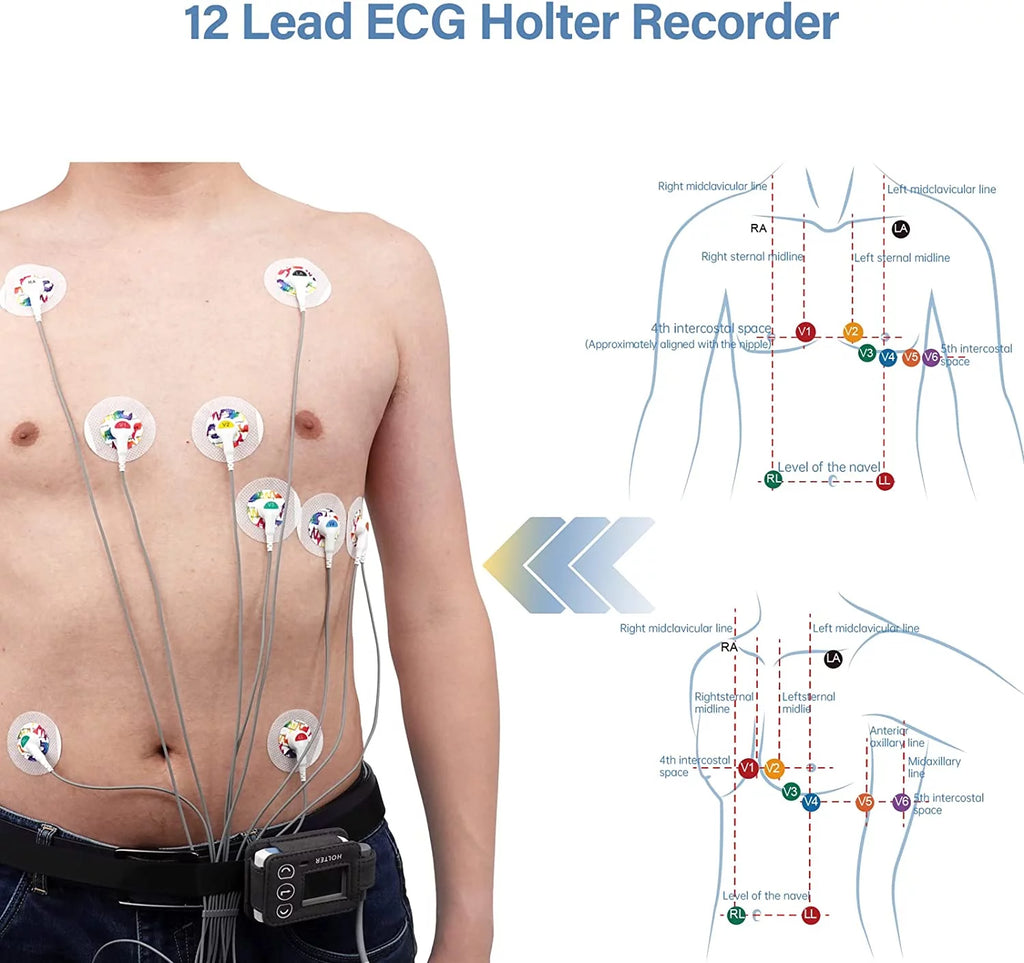 8 Channel 12-Lead EKG Machine, 24-Hour Holter Heart Monitor Y397167