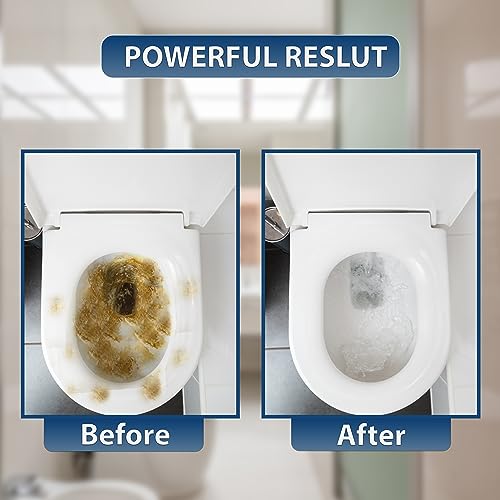 Toilet Ring Remover Z40221